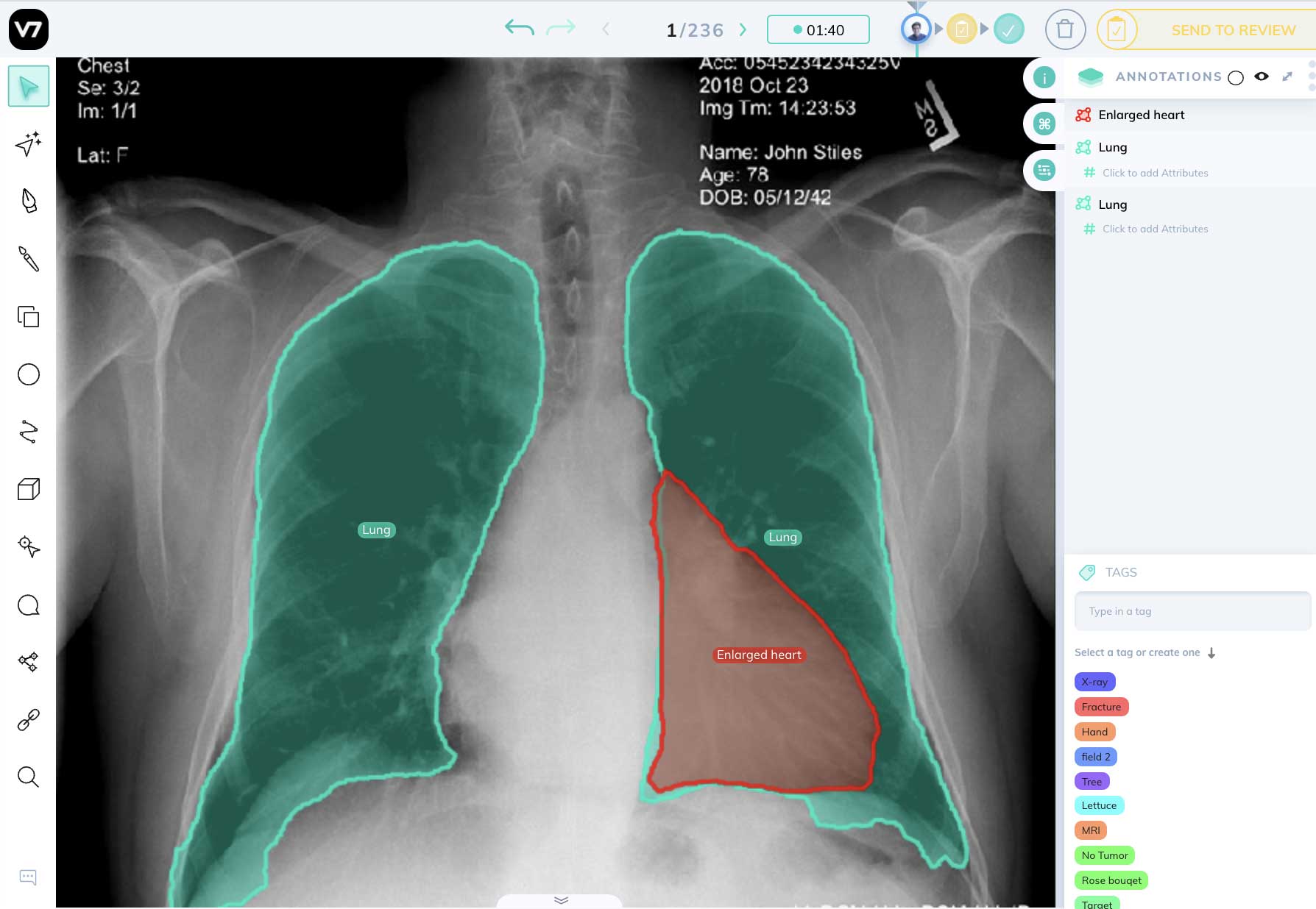 Augmented reality|
Visually Enhancing and Annotating Objects